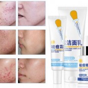 韩纪祛痘修护三件套装 美白补水控油去痘印化妆品
